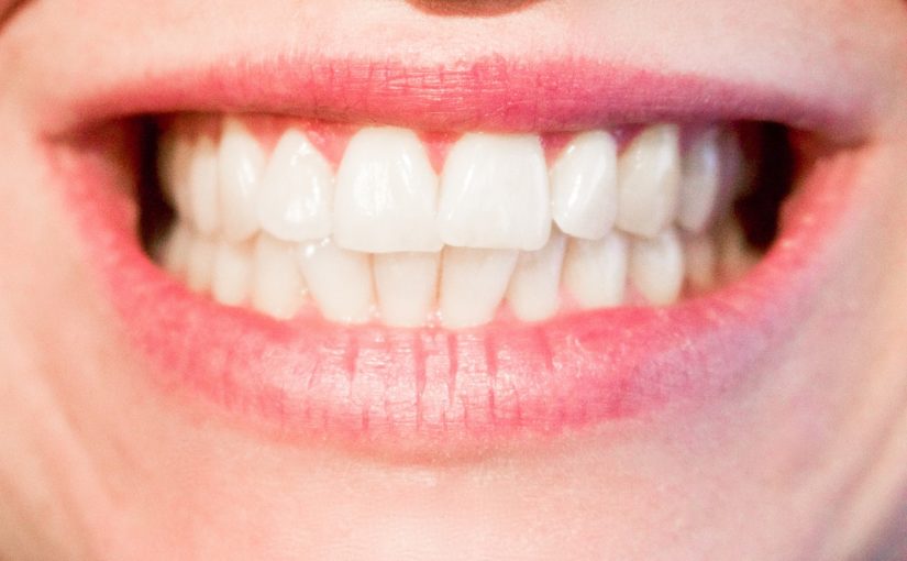 Nowoczesna technika wykorzystywana w salonach stomatologii estetycznej może spowodować, że odbierzemy piękny uśmiech.